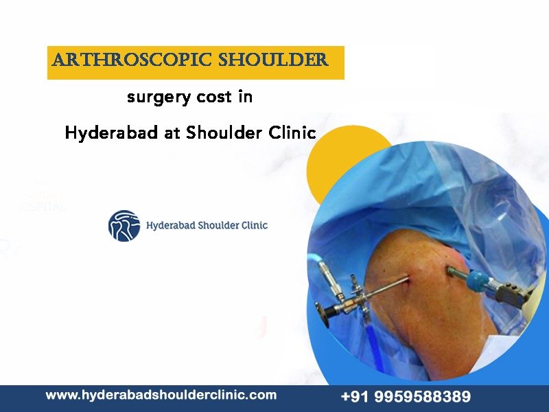 You are currently viewing Arthroscopic shoulder surgery cost in Hyderabad at Shoulder Clinic