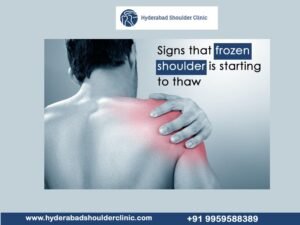 Read more about the article Signs that the frozen shoulder is starting to thaw