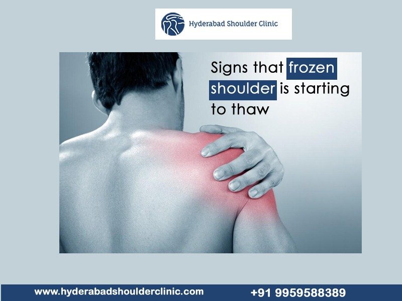 You are currently viewing Signs that the frozen shoulder is starting to thaw