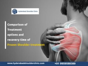 Read more about the article Comparison of Treatment options and recovery time of Frozen Shoulder treatment