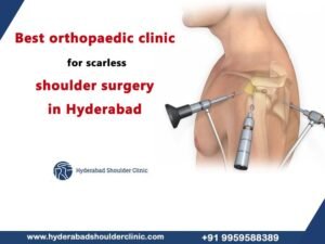 Read more about the article Best orthopaedic clinic for scarless shoulder surgery in Hyderabad