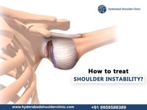 Read more about the article How to treat shoulder instability?