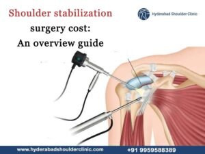 Read more about the article Shoulder stabilisation surgery cost: An overview guide