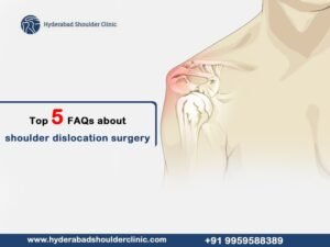 Read more about the article Top 5 FAQs about shoulder dislocation surgery