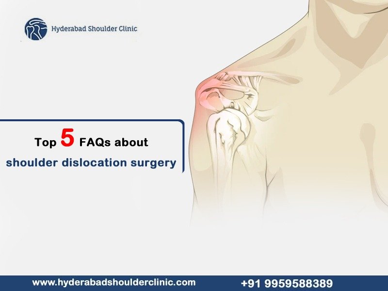 You are currently viewing Top 5 FAQs about shoulder dislocation surgery