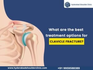 Read more about the article What are the best treatment options for clavicle fractures?