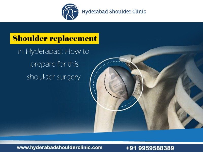 You are currently viewing Shoulder replacement in Hyderabad: How to prepare for this shoulder surgery