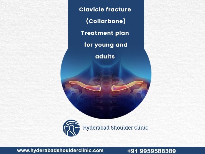 You are currently viewing Clavicle fracture (Collarbone) Treatment plan for young and adults
