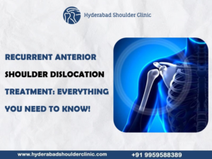 Read more about the article Recurrent anterior shoulder dislocation treatment: Everything you need to know!