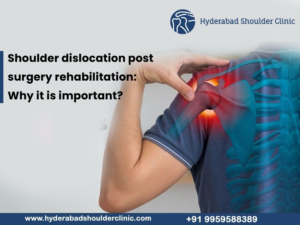 Read more about the article Shoulder dislocation post-surgery rehabilitation: Why is it important?