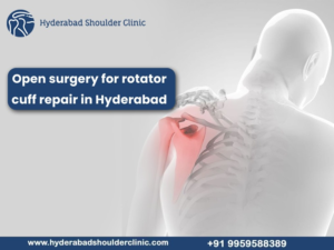 Read more about the article Open surgery for rotator cuff repair in Hyderabad