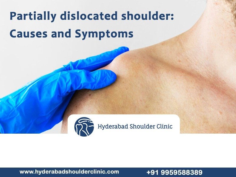 Read more about the article Partially dislocated shoulder: Causes and Symptoms