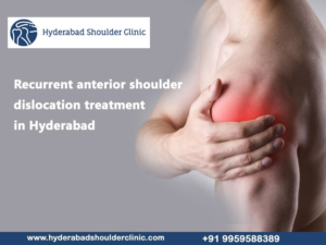 Read more about the article Recurrent anterior shoulder dislocation treatment in Hyderabad