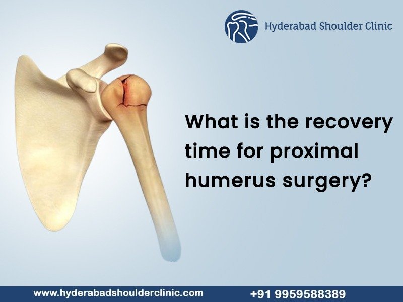 You are currently viewing What is the recovery time for proximal humerus surgery?