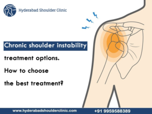 Read more about the article Chronic shoulder instability treatment options. How to choose the best treatment?